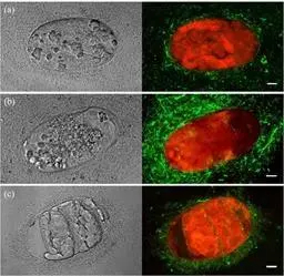 Antagonistische Aktivit&auml;t von Bacillus firma